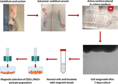 Umbilical Cord Pericytes Provide a Viable Alternative to Mesenchymal Stem Cells for Neonatal Vascular Engineering